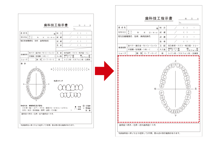 歯科技工指示書等のデザインテンプレートの役割について 伝票印刷のプリントフェスタ